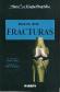 Fracturas