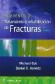 Hoppenfeld. Tratamiento y rehabilitacin de fracturas