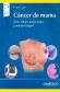 Cncer de mama Bases clnico-moleculares y manejo integral
