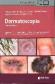 Dermatoscopia