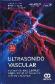 Ultrasonido vascular. Ecografa en Modo B, Doppler color y dplex, ecografa con contraste mejorado