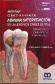 Abordaje clnico integral de mnima intervencin de la lesin de caries dental