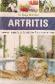 Artritis