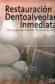Restauraci�n Dentoalveolar Inmediata
