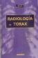 Radiologa de Trax