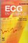ECG en Ejemplos