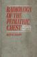 Radiology of the pediatric chest