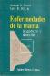 Enfermedades de la mama