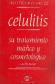 Celulitis