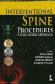 Interventional Spine Procedures