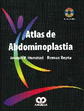 Atlas de Abdominoplasta