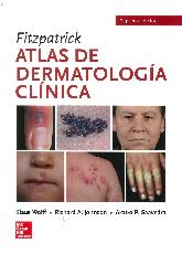 Fitzpatrick Atlas de Dermatología Clínica