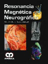 Resonancia Magntica Neurogrfica