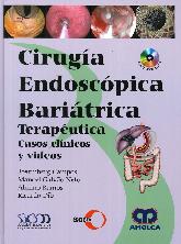 Cirugía Endoscópica Bariátrica