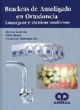 Brackets de Autoligado en Ortodoncia