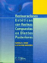 Restauraciones estticas con resinas compuestas en dientes posteriories