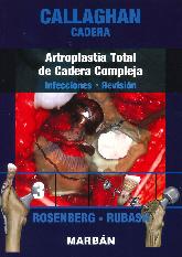 Callaghan Cadera Artrosplastia Total de Cadera Compleja