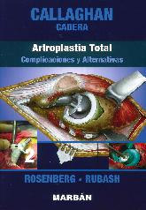 Callaghan Cadera Artroplastia Total