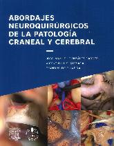 Abordajes neuroquirurgicos de la patologa craneal y cerebral