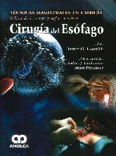 Ciruga del esfago