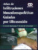 Atlas de infiltraciones musculoesqueléticas guiadas por ultrasonido