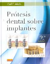 Prtesis dental sobre implantes