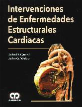 Intervenciones de enfermedades estructurales cardiacas