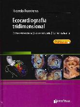 Ecocardiograga tridimensional