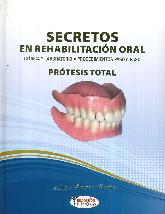 Secretos de la Rehabilitacin Oral   Prtesis Total