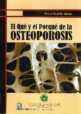 El Qu y el Porqu de la Osteoporosis