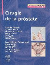 Ciruga de la Prstata