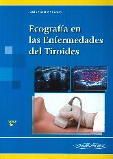 Ecografa en las Enfermedades del Tiroides