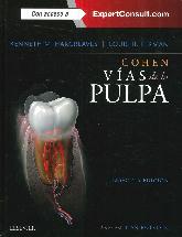 Vas de la Pulpa Cohen