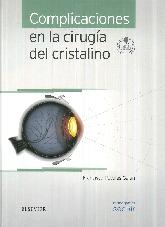 Complicaciones en la Ciruga del Cristalino