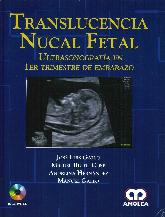 Translucencia Nucal Fetal