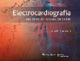 Electrocardiografa