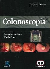 Colonoscopia