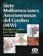 Siete malformaciones arteriovenosas del cerebro (MAV)