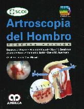 Artroscopia del Hombro