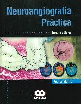 Neuroangiografa Prctica