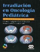 Irradiacion en oncologia Pediatrica