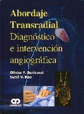 Abordaje Transradial