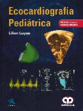 Ecocardiografa peditrica