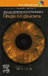 Cirugia del Glaucoma