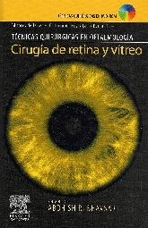 Cirugia de retina y vitreo