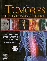 Tumores de la columna vertebral con CD Room