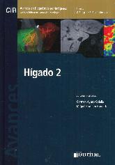 Higado 2