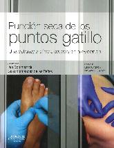 Puncin seca de los puntos gatillo