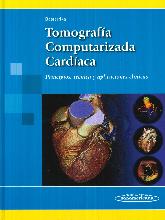 Tomografa Computarizada Cardaca