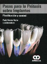 Pasos para la Prtesis sobre Implantes